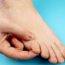 Mykóza nehtů a kůže: Příznaky, prevence a léčba